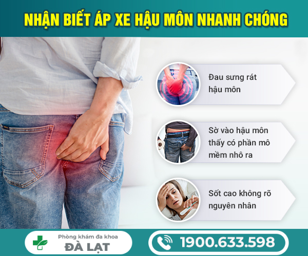 Hình ảnh minh họa